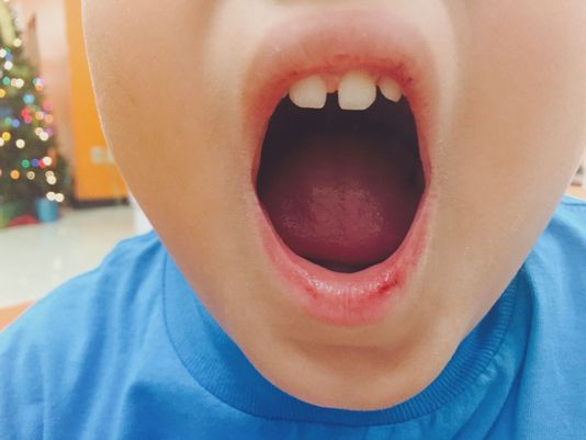 Mom Ymca Worker Duct Taped My Sons Mouth Closed 