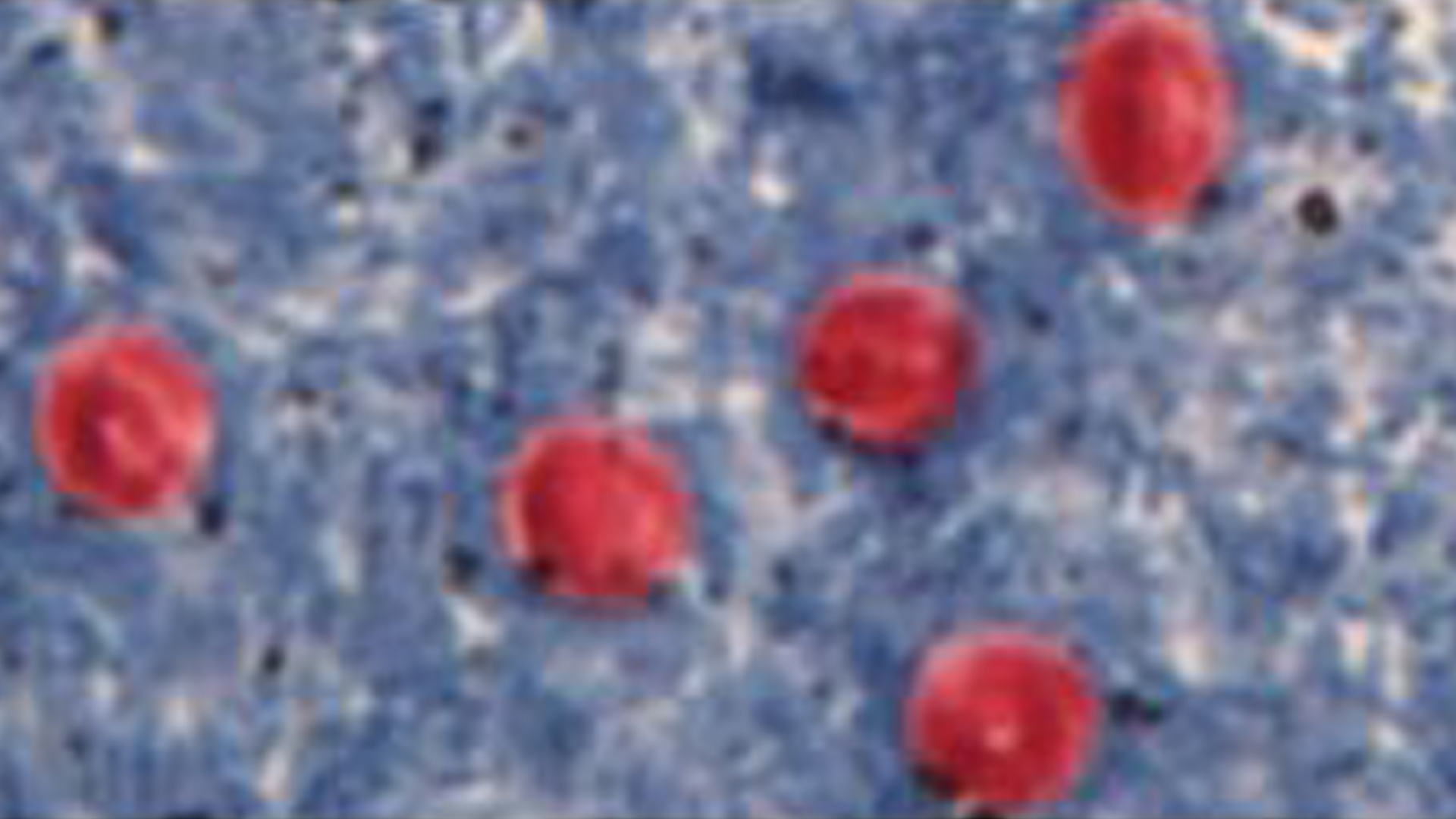 Cases of Crypto increase in Hillsborough | wtsp.com