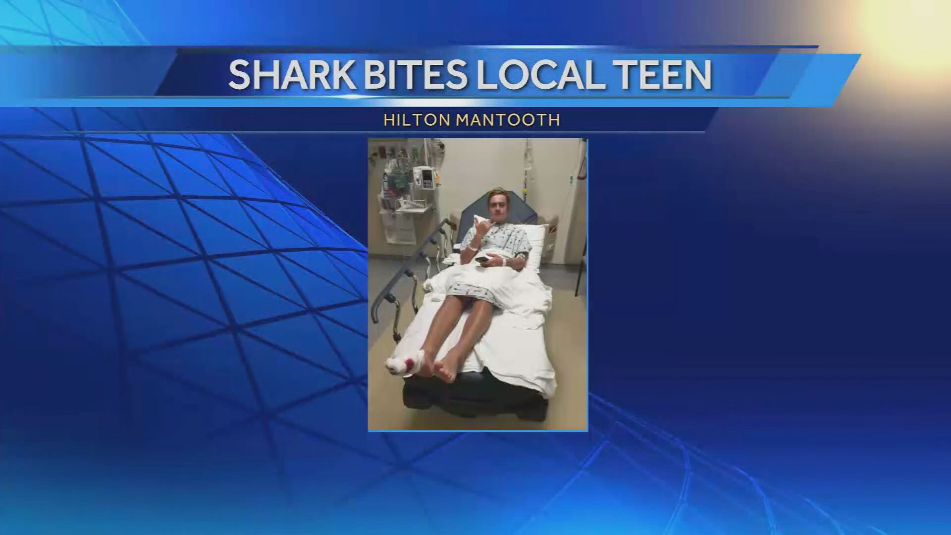 Surfers Bitten By Sharks At New Smyrna Beach