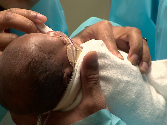 North Carolina Hospital Celebrates 'One of the World's Smallest