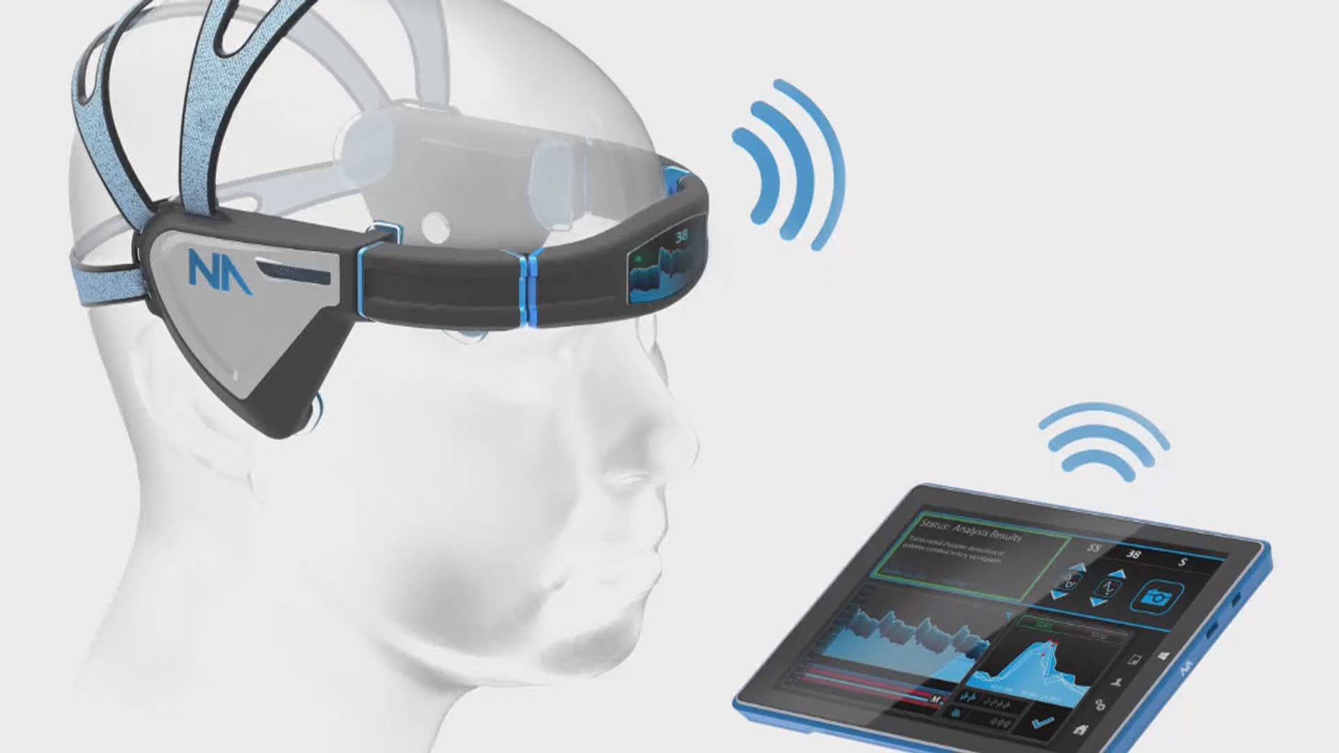 Ultrasound headset could help detect concussions faster | wtsp.com